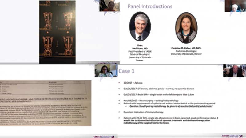 V&iacute;deo do tumor board de c&acirc;ncer de pulm&atilde;o est&aacute; dispon&iacute;vel